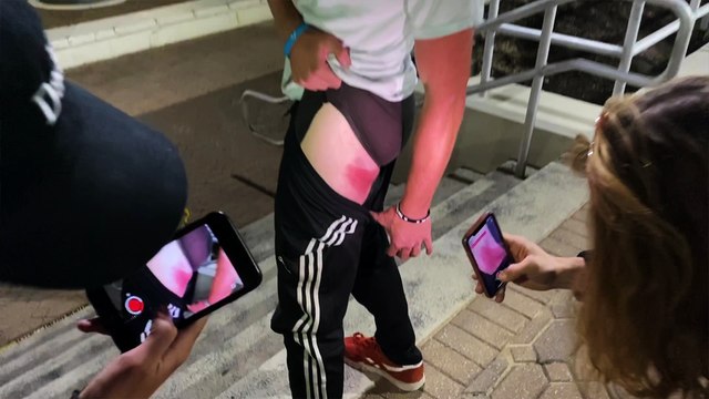 'Thrill seeker gets a WOUNDED THIGH after botching a BIG running jump '