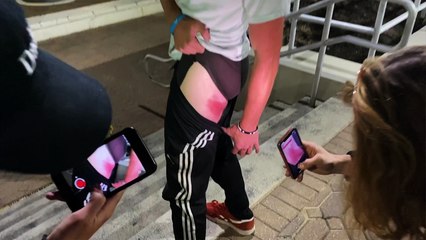 'Thrill seeker gets a WOUNDED THIGH after botching a BIG running jump '