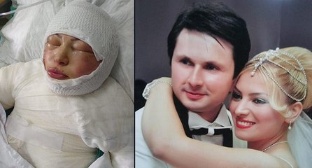 Ateşe verdiği eski eşi Elvan’ı yanarken izlemiş