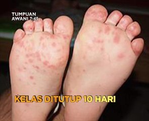 Tumpuan AWANI 7:45 - Royalti minyak diperhalusi, kelas ditutup 10 hari & kadar diabetes tertinggi di Asia