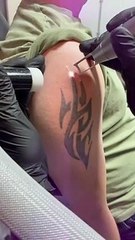Man gets tattoo lasered away by ClearLase Tattoo Removal
