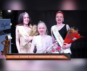 Hapus stigma, Zimbabwe anjur pertandingan ratu cantik albino