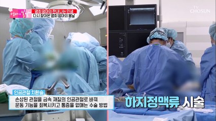 관절 사이에 연골이 모두 마모된 엄마의 상태 TV CHOSUN 20220227 방송