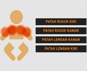 Bayi 46 hari menderita sebelum maut
