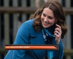 Kate Middleton derma rambut