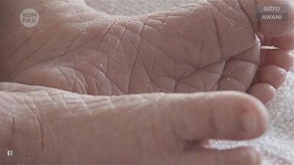 Kompak (Episod 156): Bayi mati, hidup semula