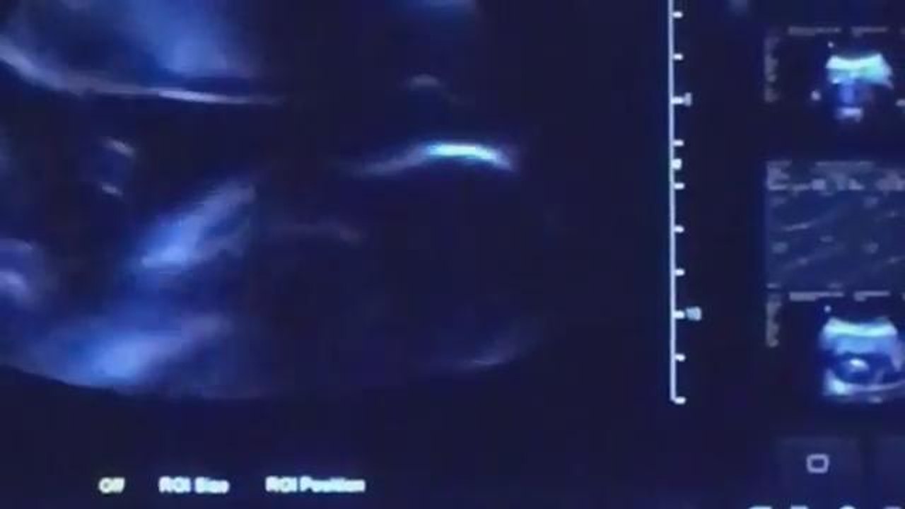 Siti Nurhaliza beri bayangan timang bayi perempuan?