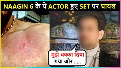 This Popular Actor From Naagin 6 Gets Injured On Set , Share Photos