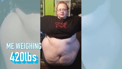 I Lost 246lbs - Today I Reveal My Excess Skin | BRAND NEW ME