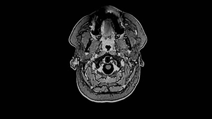 'Sonogenetics' Allow Researchers to Control Brain Cells in Animals Using Ultrasound
