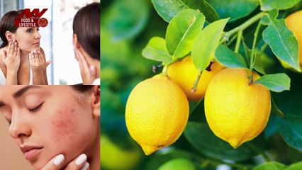 नहाते टाइम इन बातों का रखें ध्यान, स्किन को झेलने पड़ सकते हैं भारी नुकसान |Body Acne Causes|Beauty Tips|