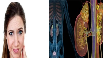 Face पर Swelling होना kidney की इस बीमारी के Symptoms, तुरंत ले Expert Advise |Boldsky