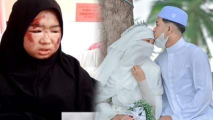 Bukti lelaki setia belum pupus, pemuda Terengganu ini sanggup peristerikan wanita wajah penuh luka!
