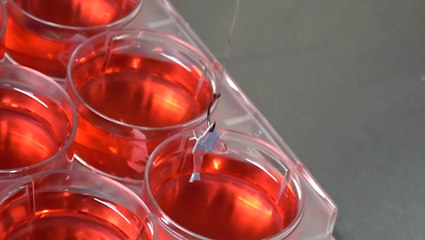 This tiny fish made from human heart cells could revolutionize cardiac treatment