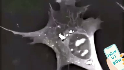 Nerve cell death process 3d animation