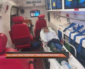 Kaki kanak-kanak perempuan 7 tahun, tersepit rim tayar