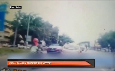 Kanak-kanak patah tangan tersepit rim motor