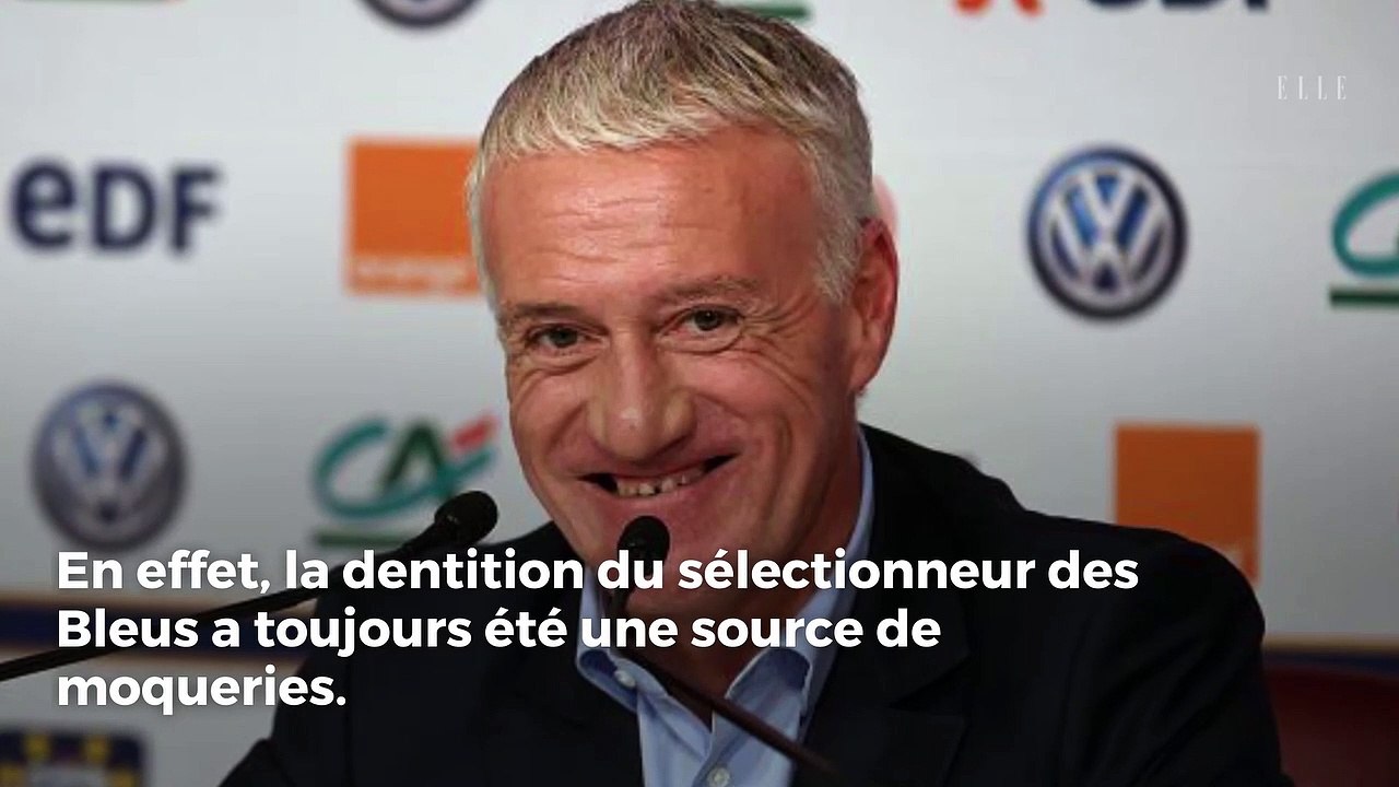 Didier Deschamps s’est fait refaire les dents et la photo fait le buzz !