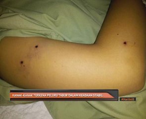 Kanak-kanak terkena peluru tabur dalam keadaan stabil