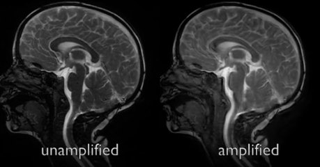 Researchers reveal the surprising motions in the brain while the heart pumps blood