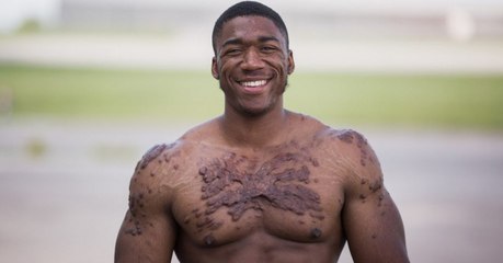 He couldn't bear to look in the mirror and now he's a bodybuilding champion