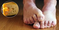This is the real reason why feet smell like cheese