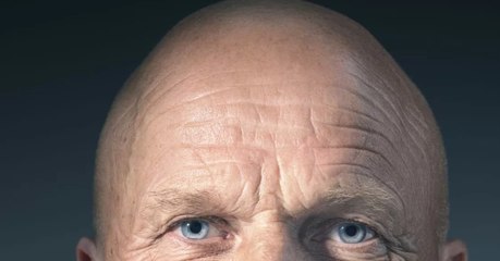 Scientists may have found a way to reverse baldness!