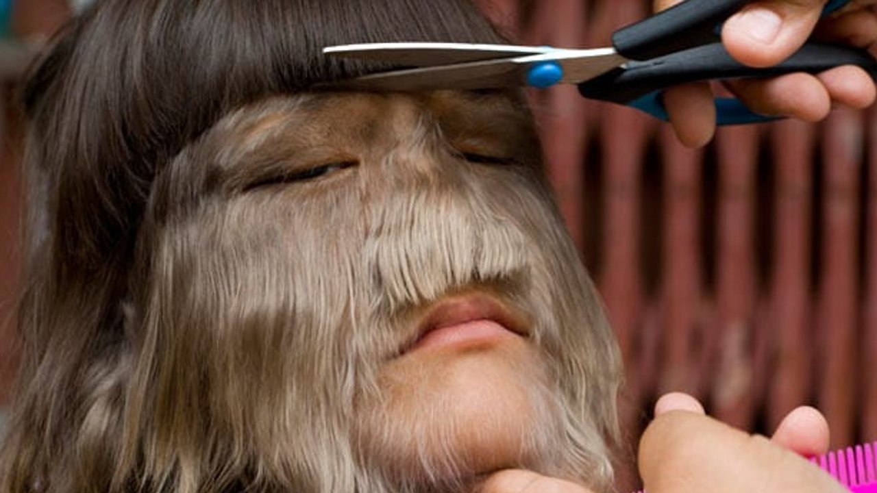 This is what the 'world's hairiest girl' looks like now