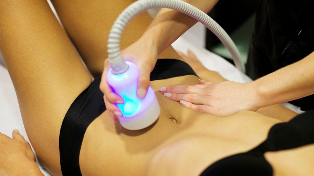 La cryolipolyse, du froid pour perdre quelques centimètres durablement