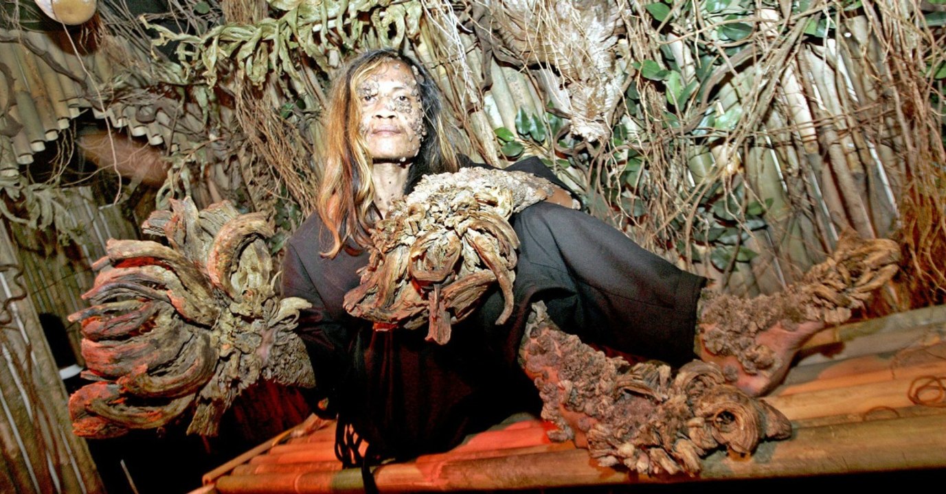 Treeman: Did He Ever Get Cured?