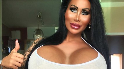 This woman's chest weighs 10lbs