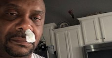 Doctors were shocked to see what was really dripping from this man's nose