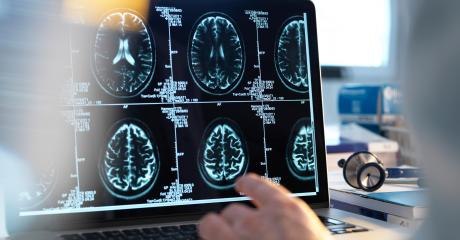 These Strange White Marks in a Man’s Brain Were His Worst Nightmare Come to Life