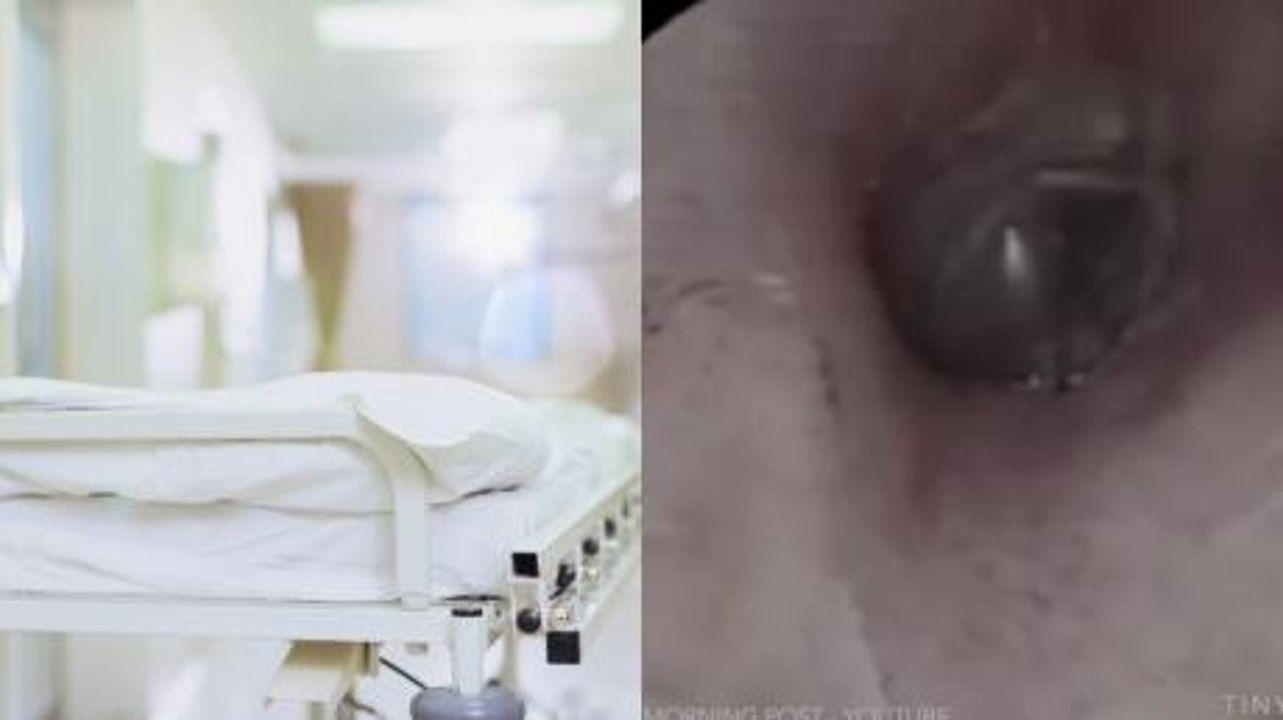 He found something terrifying living in his ear