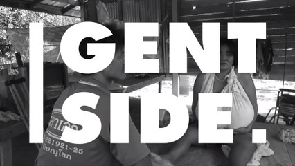 This woman’s chest won't stop growing and doctors can't figure out why