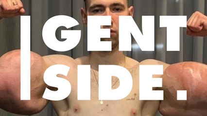 The 'synthol kid' is giving up his popeye like arms