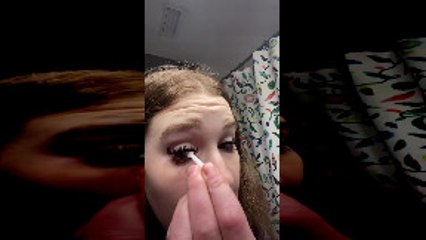 Contact Lens Plunger Gets Stuck Directly on Woman's Eye