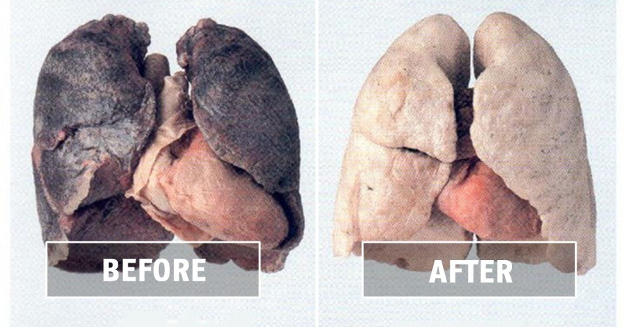 how safe are herbal cigarettes Amazon.com: Honeyrose BLUE Tobacco & Nicotine Free Herbal Sticks : Health &  Household