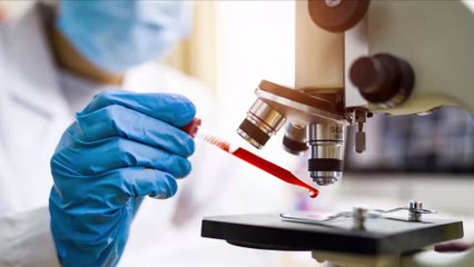 What Does COVID-19 Look Like Under a Microscope?