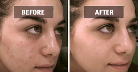 Get rid of stubborn spots with these quick fixes