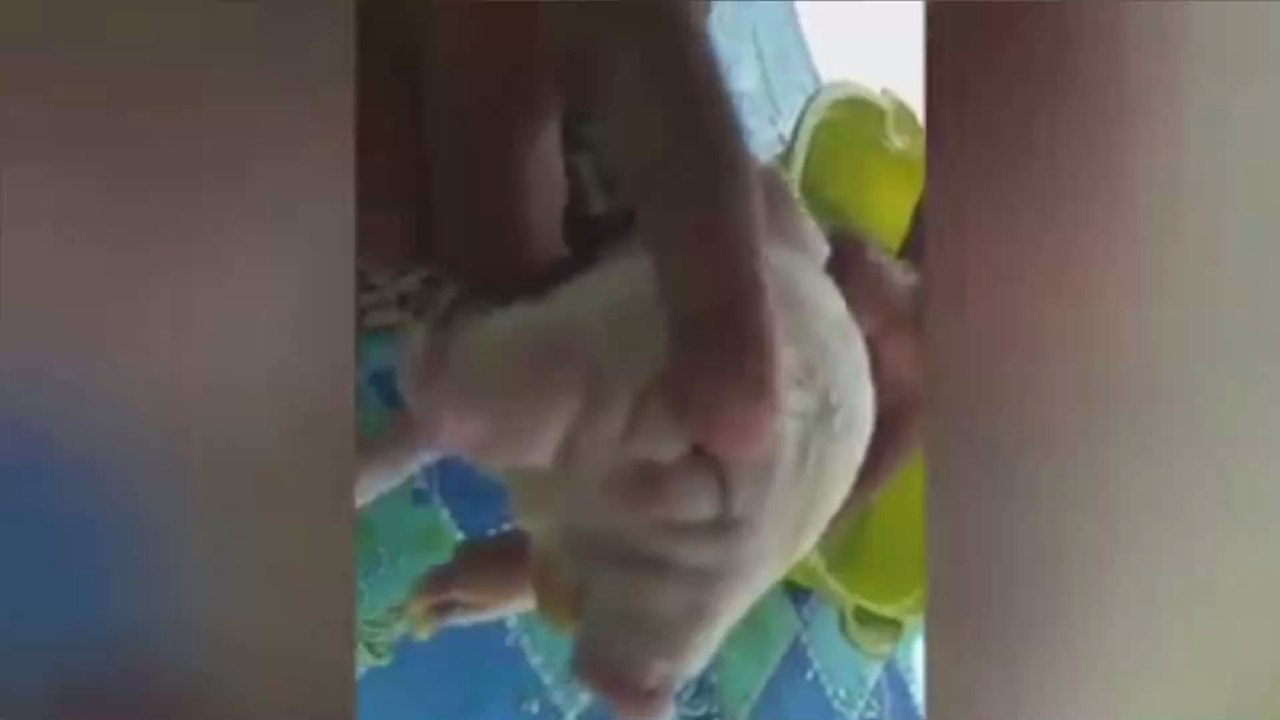 This Piglet Born with Two Heads and Three Eyes Is Going Viral on Social Media