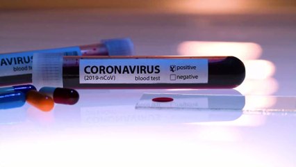 COVID-19 Vaccine From Oxford University Shows 'Promising Results' Amidst Human Trials