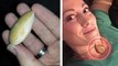 She Got A Necklace From Her Boyfriend... One Year Later She Found Something Incredible Inside It