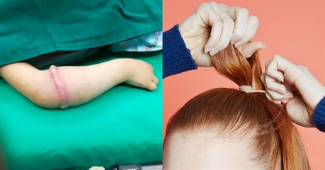 This little girl left doctors baffled from a strange rash