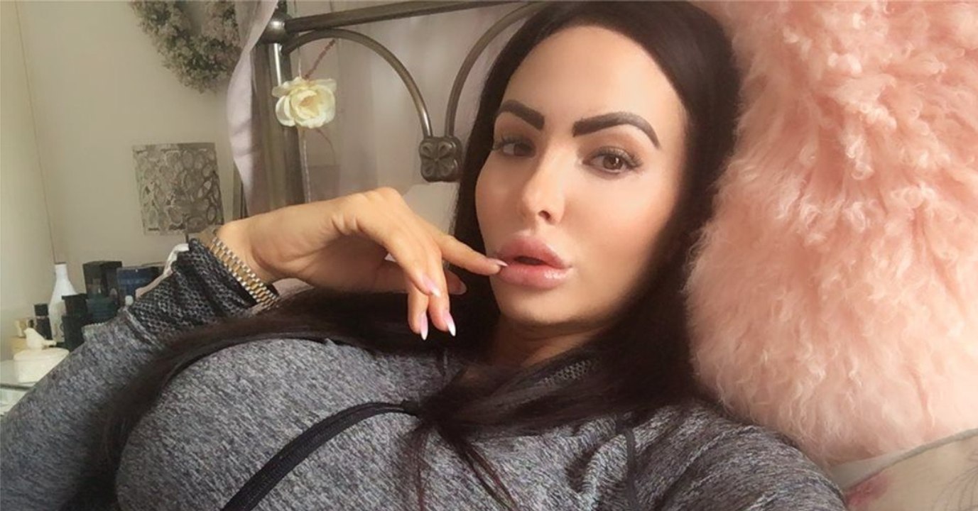 This Woman Spent Thousands On Plastic Surgery, Now She Can No Longer Sit Down