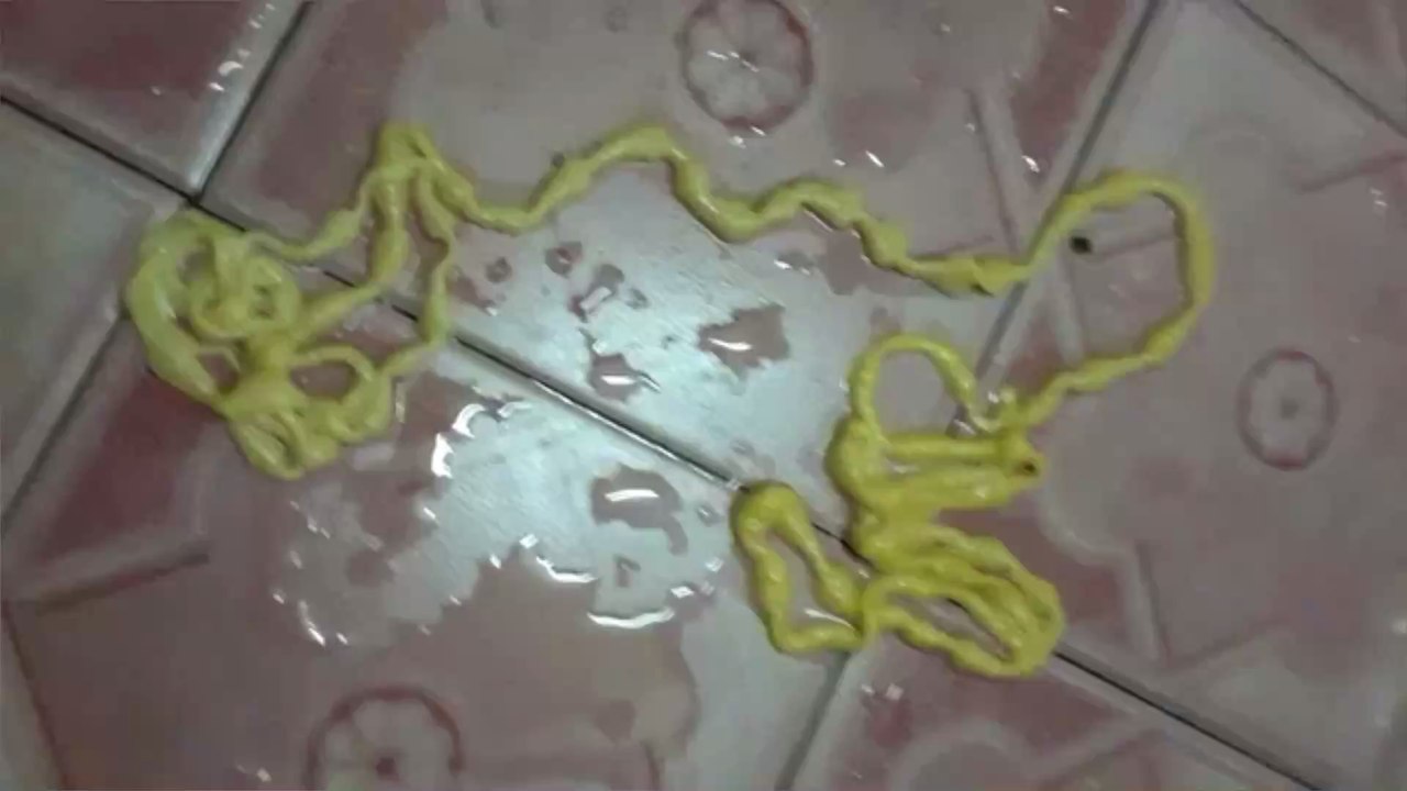 Man left disturbed after pulling 5 metre 'alien' tapeworm from his rear