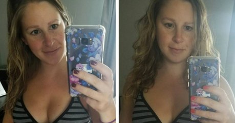 Body positivity: This woman's photos of her post-birth stomach went viral