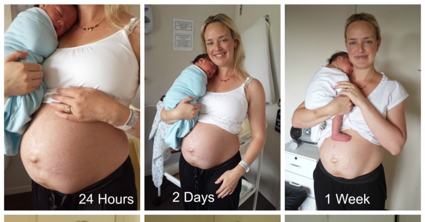 After sharing candid photos of her post-baby body this woman inspired many new mums
