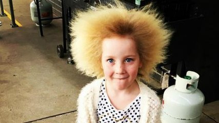 This Little Girl Is One of 100 People in the World Who Suffer From This Extremely Rare Syndrome