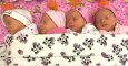 She gave birth to quadruplets and their faces revealed something very rare